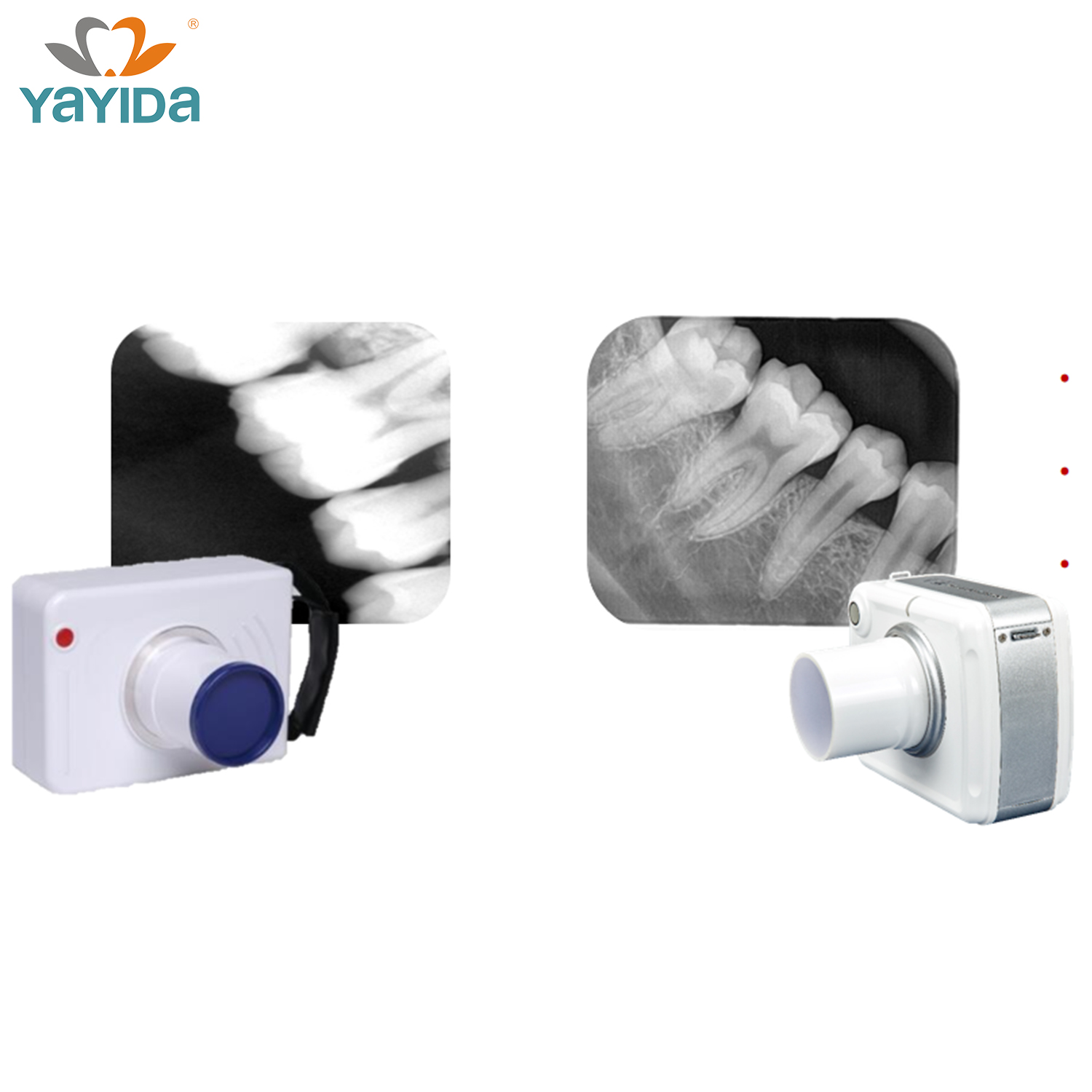 Fabricantes de máquinas de rayos x dentales portátiles de alta frecuencia profesionales personalizados YAYIDA de China | YAYIDA